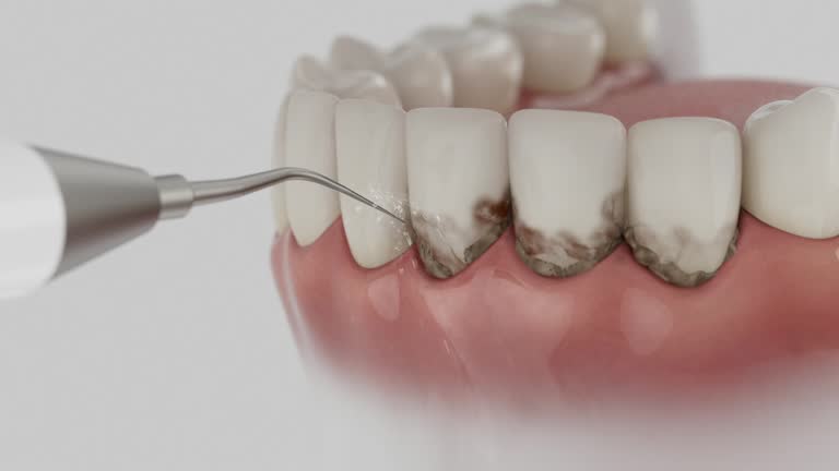 Reliable Dental contractor in Hamilton, MT by Smile Center Dentistry